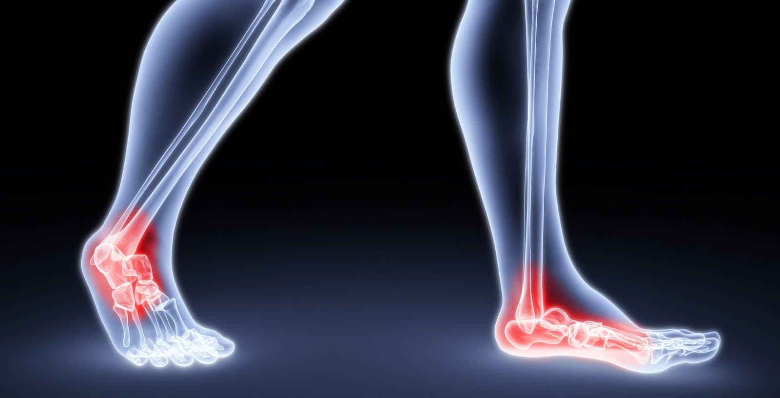 Low ankle sprains versus High ankle sprains: Orthopedic Center for