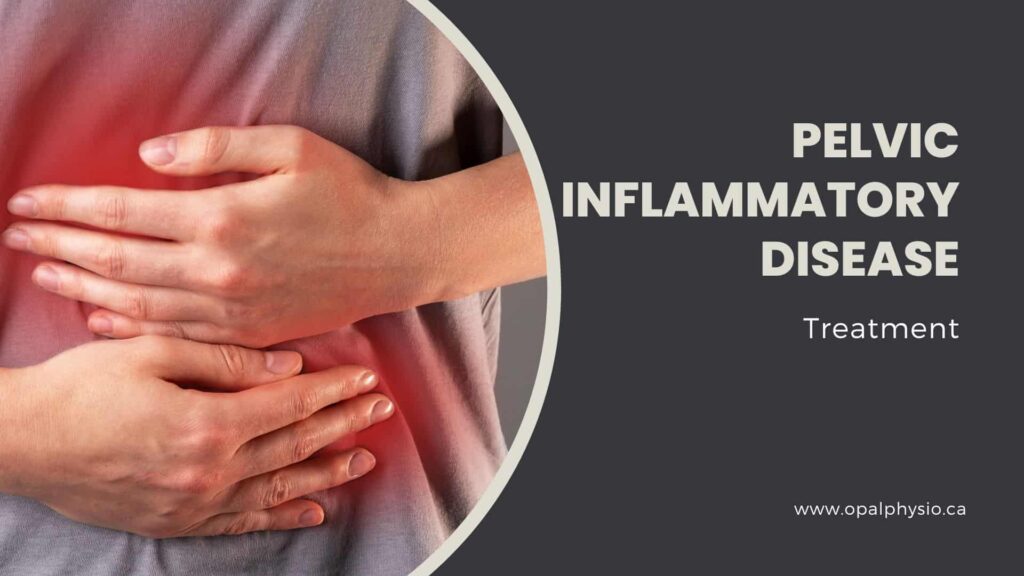Pelvic Inflammatory Disease Treatment