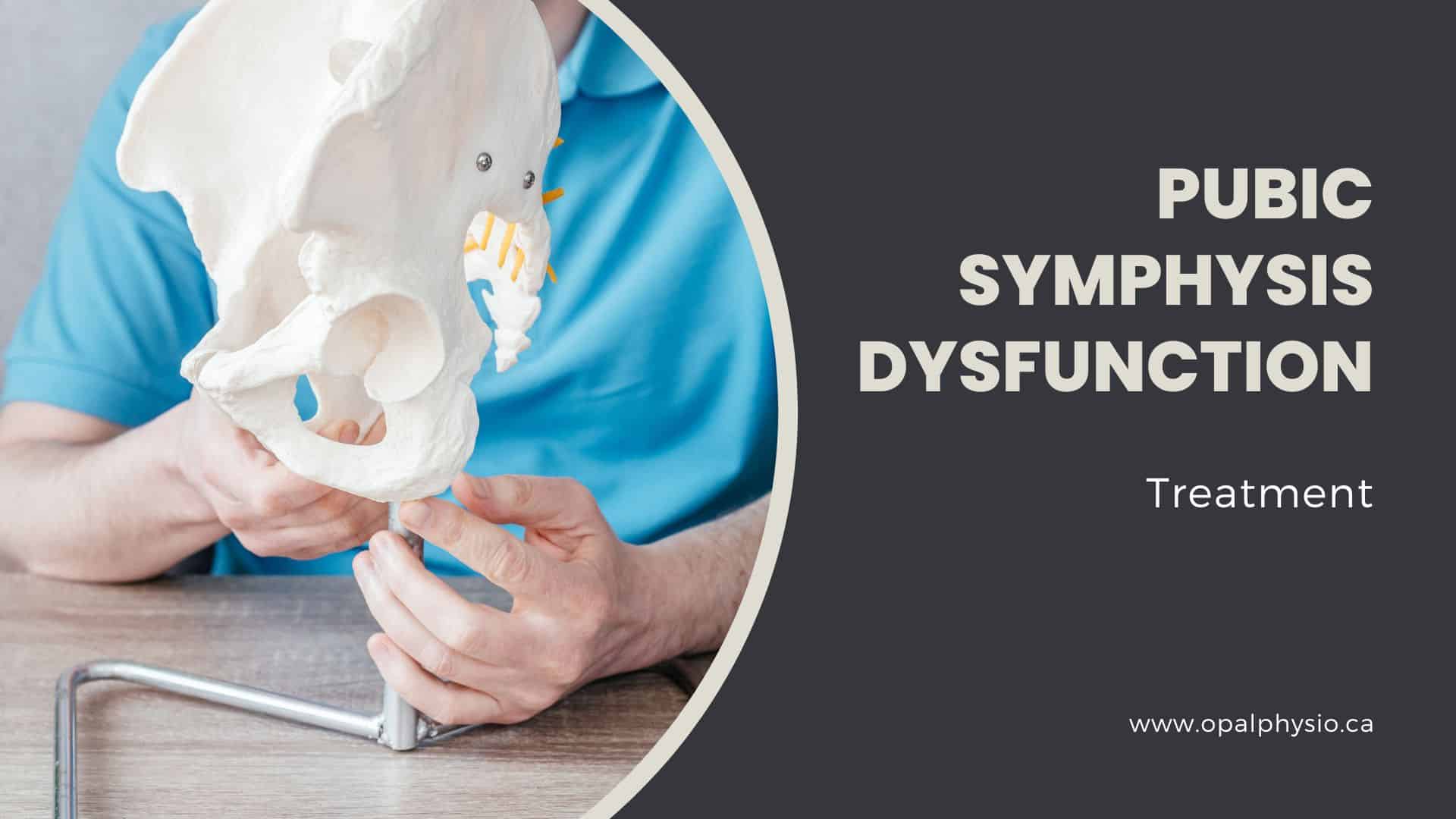 Pubic Symphysis Dysfucntion