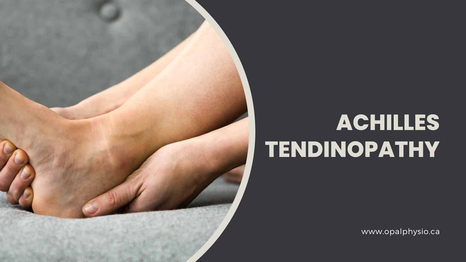 Achilles tendon pain after running: FAQs - Sport Doctor London