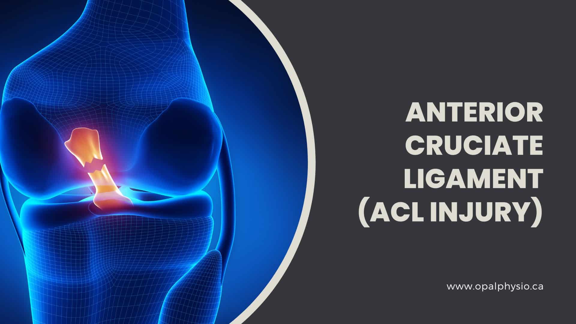 Anterior Cruciate Ligament - ACL Injury