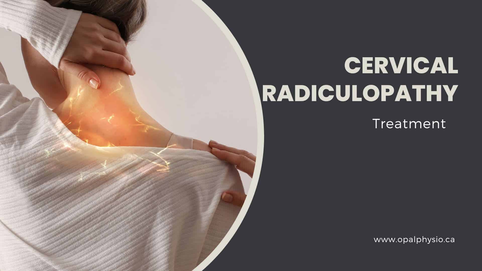 Cervical Radiculopathy