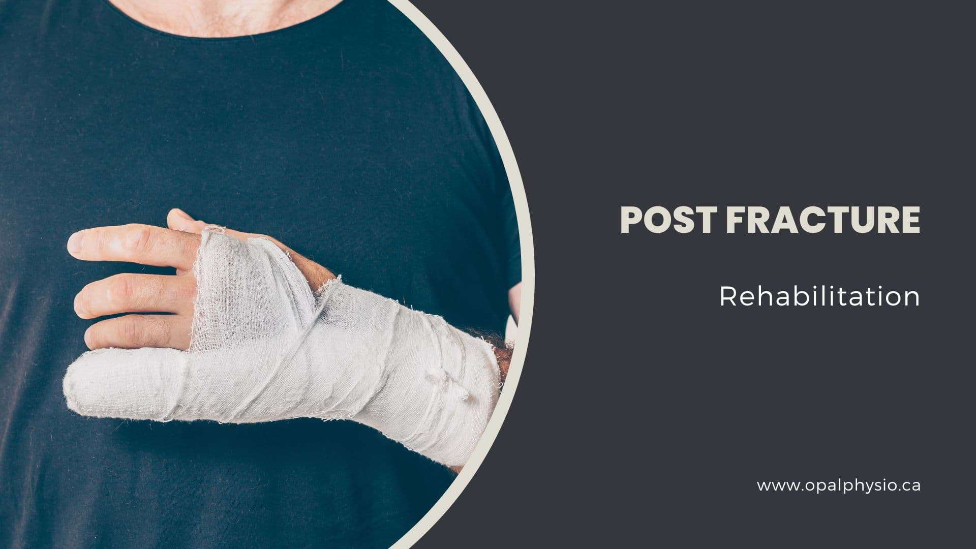 Post Fracture Physiotherapy Rehabilitation